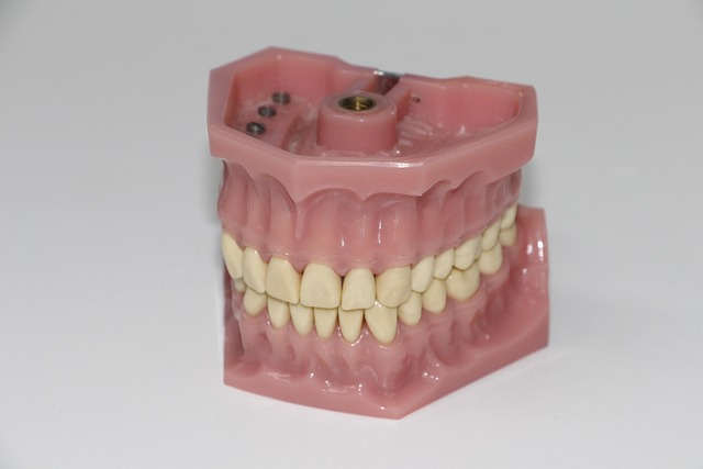 Ceramic teeth caps